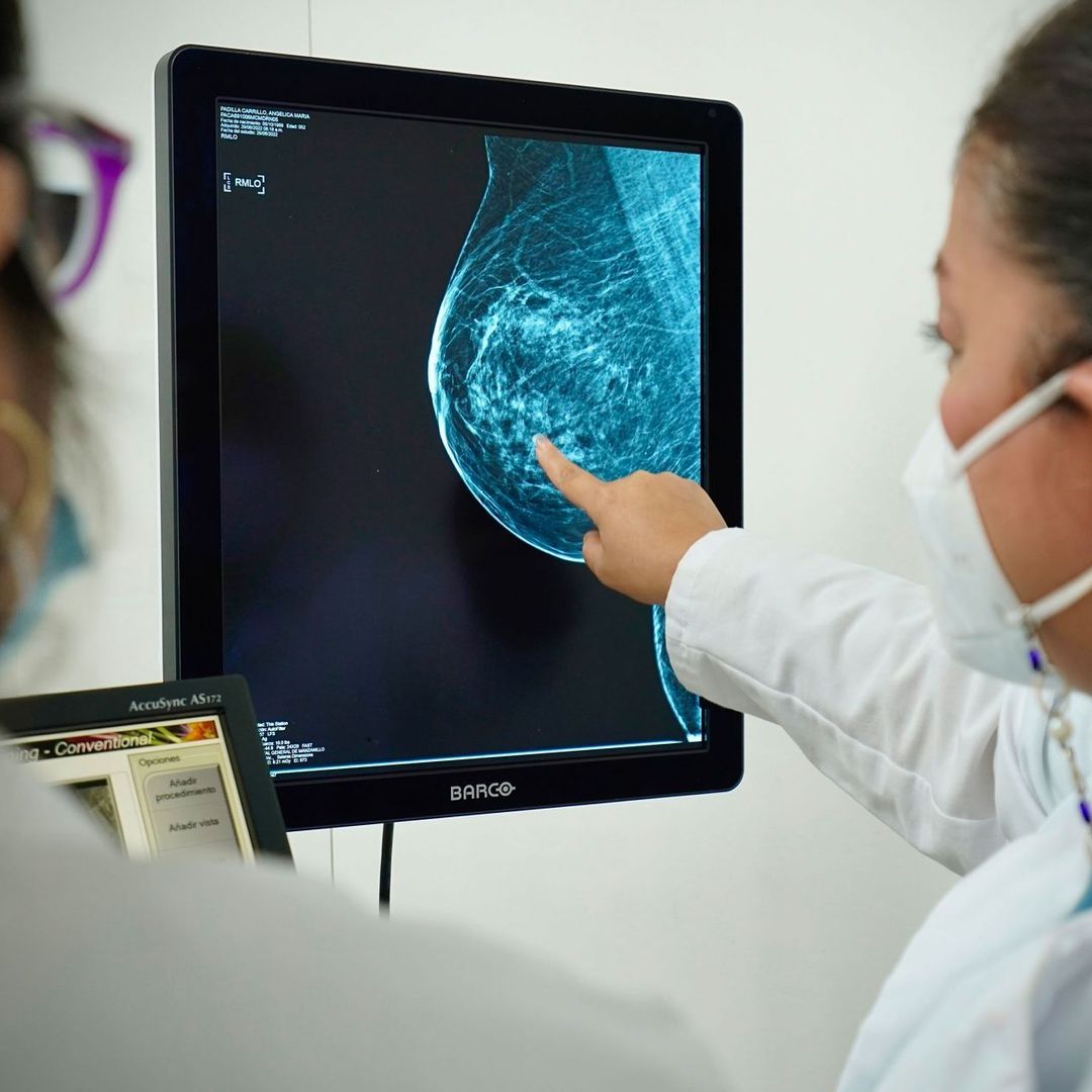 Detección temprana del cáncer de mama